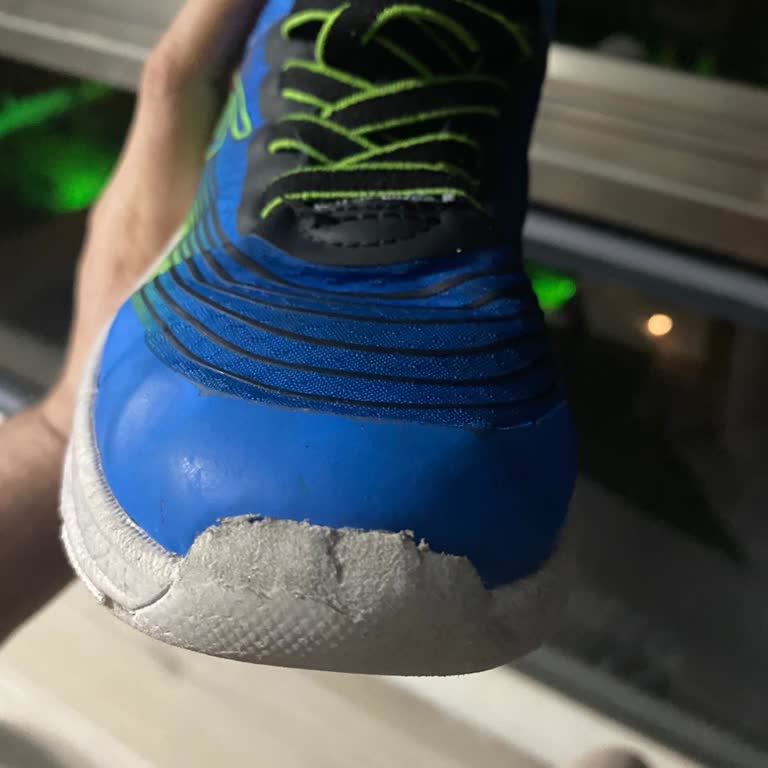 Kısa Sürede Deforme Olan Ayakkabıya Ret Cevabı Hayal Kırıklığı