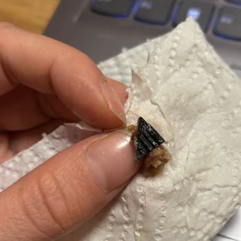 Köftenin İçinden Sert Plastik Parça Çıktı, Hayati Tehlike Atlattım