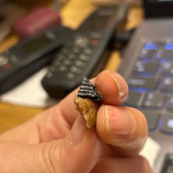 Köftenin İçinden Sert Plastik Parça Çıktı, Hayati Tehlike Atlattım