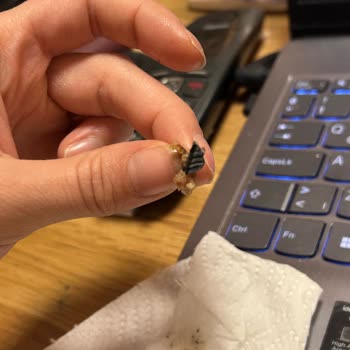 Köftenin İçinden Sert Plastik Parça Çıktı, Hayati Tehlike Atlattım