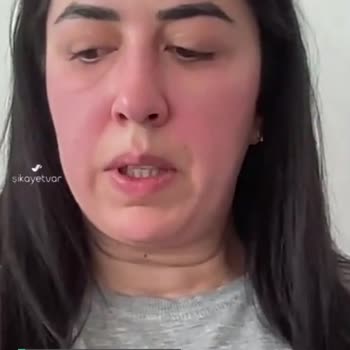 Bupa Acıbadem Sigorta Sağlık Giderlerimi Asla Karşılamıyor!