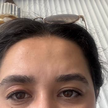 The Purest Solutions Göz Altı Serumu Sonrası Beklenmedik Cilt Reaksiyonu Yaşadım