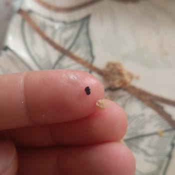 Erpiliç Köfteden Taş Çıkması Ve Sağlık Riski