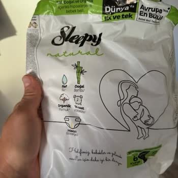 Sleepy Bebek Bezinde Topaklanma Sorunu Ve Rahatsızlık