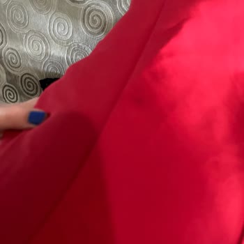 Yanık Lekeli Elbise Gönderildi, Mağduriyet Yaşıyorum