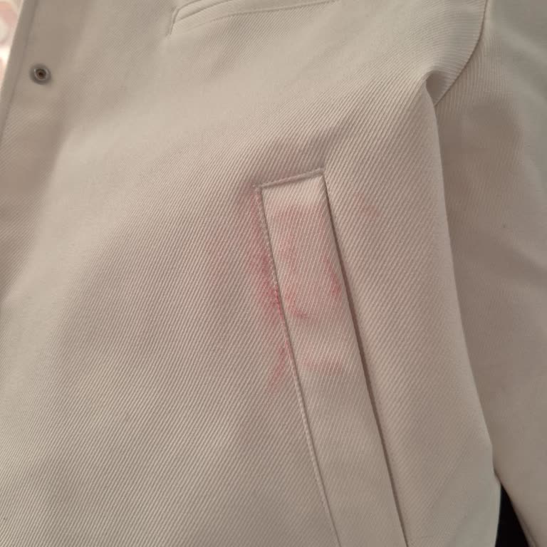 Toyzz Shop Poşetinin Kıyafetlerimi Boyaması Ve Mağduriyetim