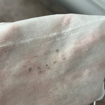 Sleepy Bebek Bakım Havlusunda Küf Sorunu Ve Kalite Düşüşü