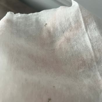 Sleepy Bebek Bakım Havlusunda Küf Sorunu Ve Kalite Düşüşü