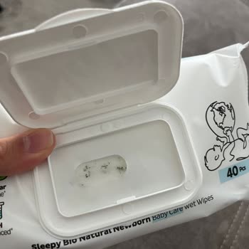 Sleepy Bebek Bakım Havlusunda Küf Sorunu Ve Kalite Düşüşü