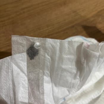 Molfix Bebek Bezinde Yabancı Cisim Şoku: Güven Sarsıldı