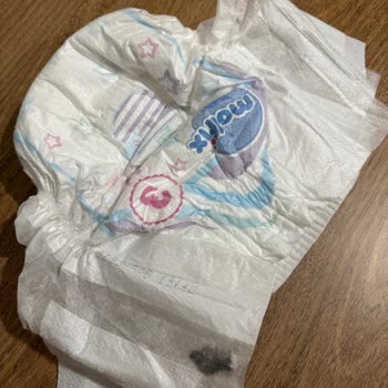 Molfix Bebek Bezinde Yabancı Cisim Şoku: Güven Sarsıldı
