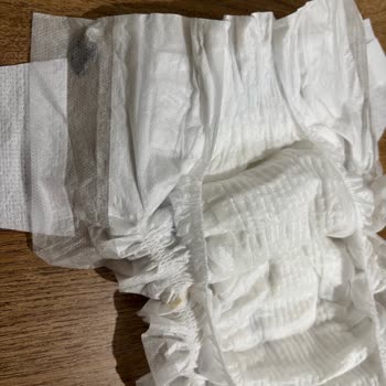 Molfix Bebek Bezinde Yabancı Cisim Şoku: Güven Sarsıldı