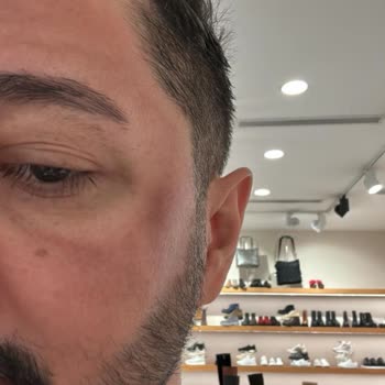 Enza Güzellik Merkezleri Cilt Lekeleri İçin Alınan Hizmetten Memnuniyetsizlik Ve Maddi Zarar