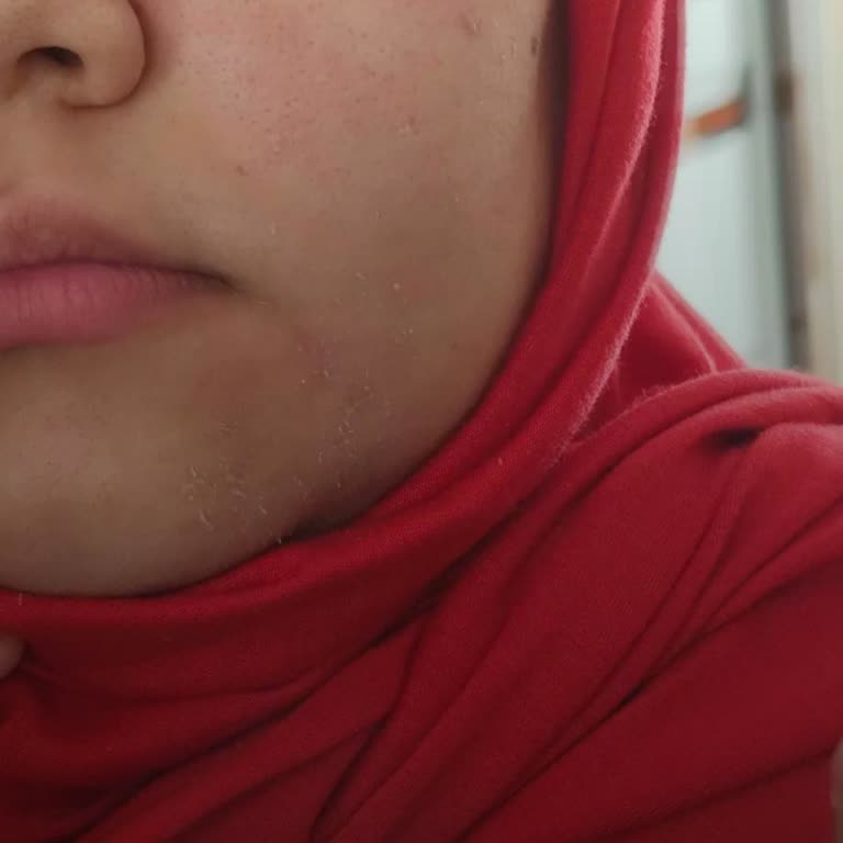 Trendyol Ceremony Krem Şikayeti