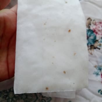 Aldığım Tüm Sleepy Islak Mendiller Küflü Çıktı, Sorun Neden Çözülmüyor