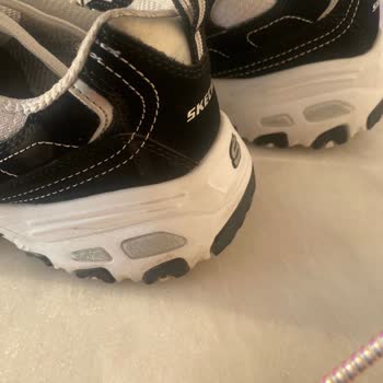 Skechers Garanti Kapsamındaki Ürünümde Yaşadığım Soruna Çözüm Bekliyorum