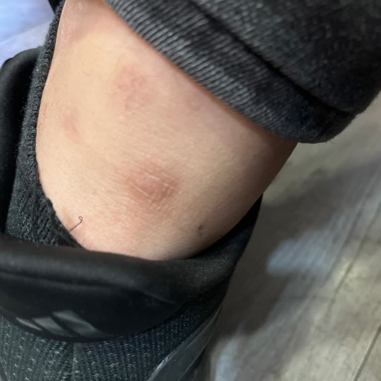 Satış Danışmanının Hatası Nedeniyle Kullanılamayan Ayakkabı Ve Çözüm Eksikliği