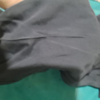 Aldığım Pantolonlarda Sürekli Beyaz Çizgi Sorunu Yaşıyorum