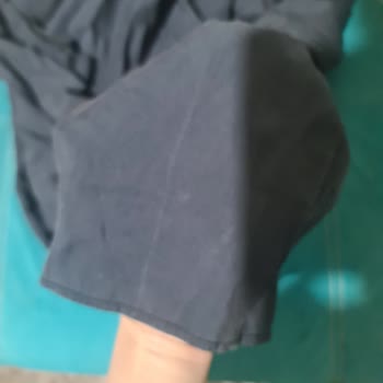 Aldığım Pantolonlarda Sürekli Beyaz Çizgi Sorunu Yaşıyorum