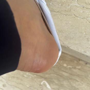 Puma Ayakkabı Ayağımı Yara Yaptı Mağduriyetim Giderilmedi