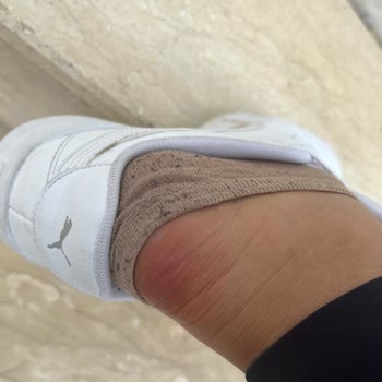 Puma Ayakkabı Ayağımı Yara Yaptı Mağduriyetim Giderilmedi