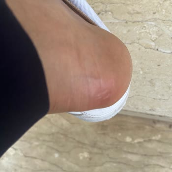 Puma Ayakkabı Ayağımı Yara Yaptı Mağduriyetim Giderilmedi