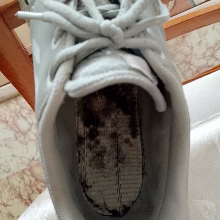 Ayakkabıda Küf Oluştu, İlgisizlik Ve Hayal Kırıklığı