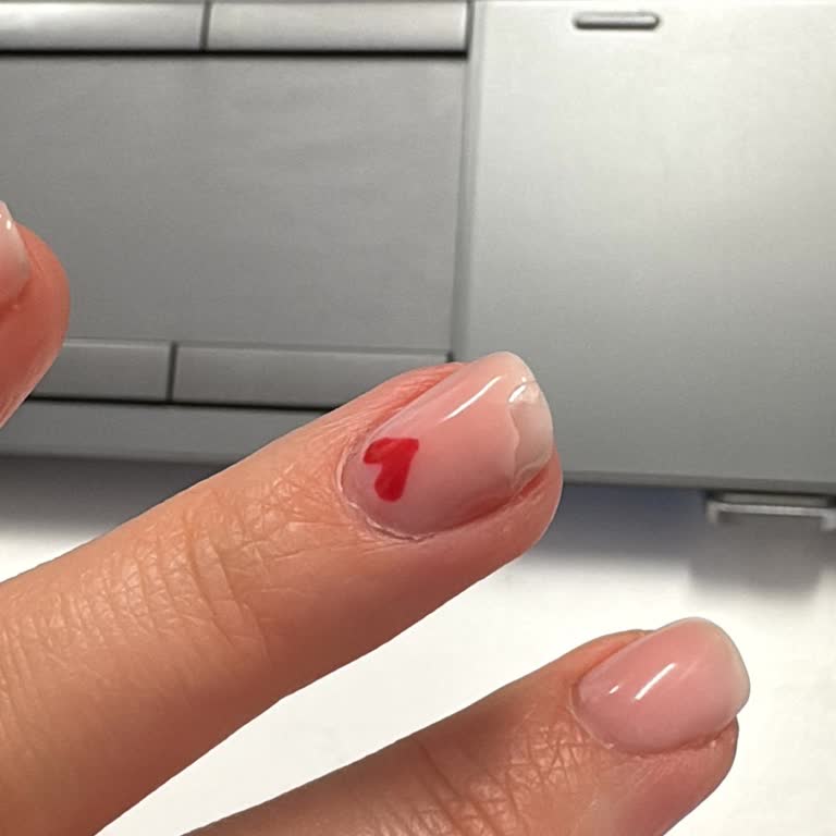 Jel Güçlendirme Sonrası Ekstra Ücret Ve Kötü Hizmet Deneyimi