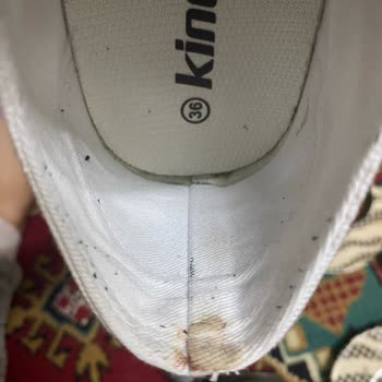 Kinetix Ayakkabı Ayağı Yaraladı Ve Hayal Kırıklığı Yaşattı