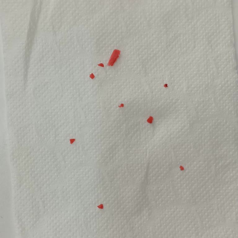 Aldığım Etten Çıkan Plastik Sağlığımı Tehdit Etti