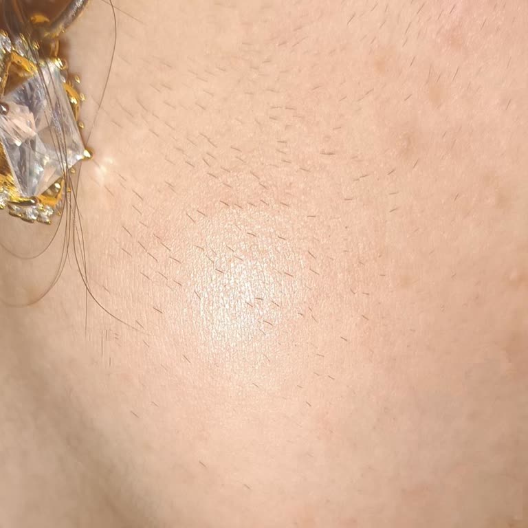 Uygulama Sonrası Tüylerim Arttı Çözüm Bulamıyorum