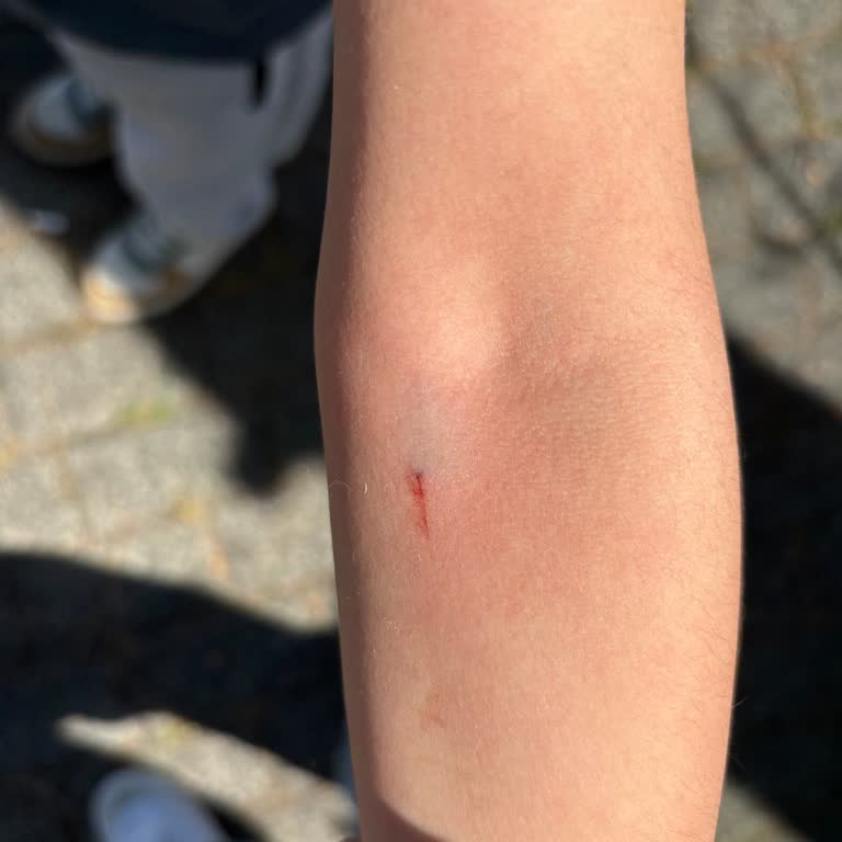 Çocuğa Uygunsuz Davranış Sergileyen Hemşire Hakkında Şikayet