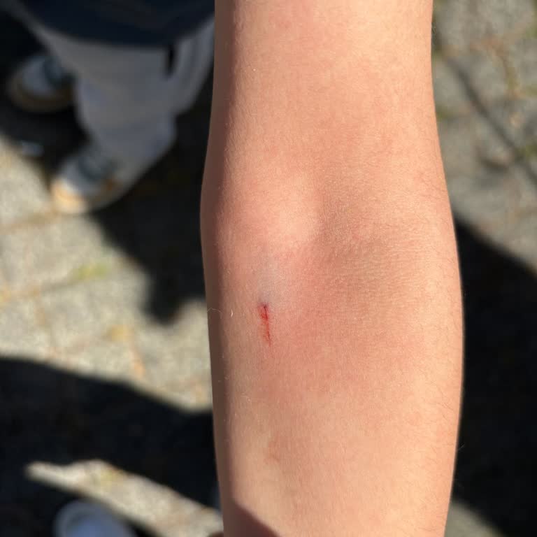 Çocuğa Uygunsuz Davranışta Bulunan Hemşire Hakkında Şikayet