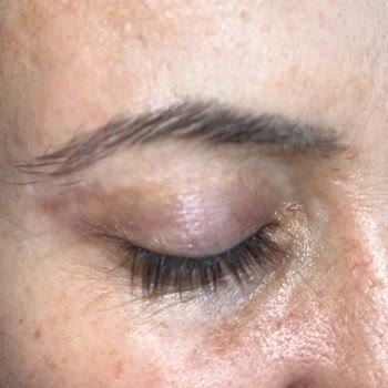 Ameliyat Sonrası Geçmeyen Şikayetler Ve İlgisizlik