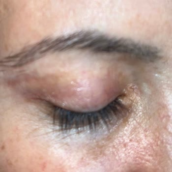 Ameliyat Sonrası Geçmeyen Şikayetler Ve İlgisizlik