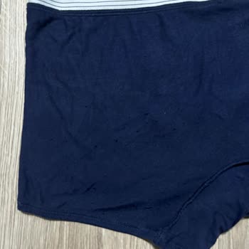Dagi Satın Alınan Üründe Pamukçuk Sorunu Ve İlgisiz Müşteri Hizmeti