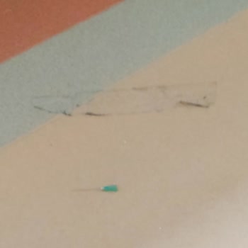 Van YYÜ Hastanesi Nöroloji Servisinde MS Hastalarına Yetersiz İlgi Ve Kötü Koşullar