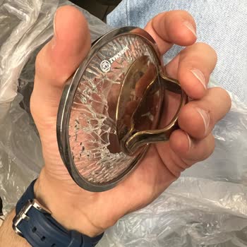 Korkmaz Çaydanlık Kapağı Sebepsiz Patladı, Parça Temin Edilemiyor