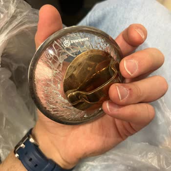 Korkmaz Çaydanlık Kapağı Sebepsiz Patladı, Parça Temin Edilemiyor