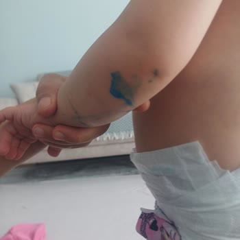 Esma Ocak Özel Eğitim Anaokulu'nda Herkes Bir Telden Çalıyor