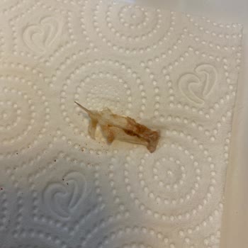 Ton Balığında Yabancı Cisim Tehlikesiyle Karşılaştım