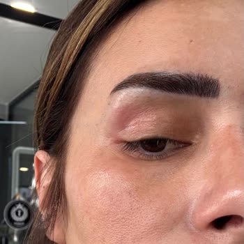 Hediye Göz Kremi Cildimde Yanma Ve Kaşıntıya Sebep Oldu