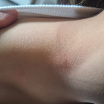 Arena Kız Çocuk Mayosunda Erken Tüylenme Ve Rahatsızlık Sorunu