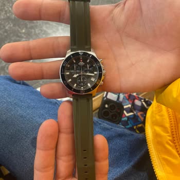 Saat Kordonunun Bilekte Yara Yapması Ve Garanti Servisinin Sorunu Çözmemesi