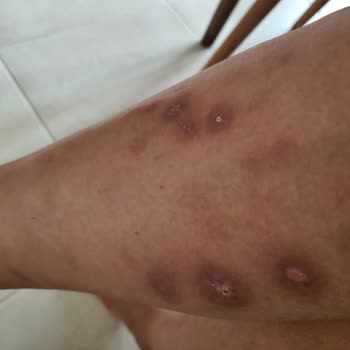 Yanlış Tedavi Sonrası Kalıcı İzler Ve Çözülmeyen Mağduriyet