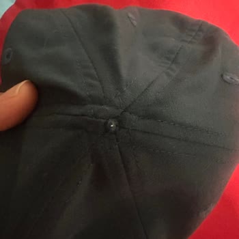 Decathlon Şapka Kusuru: Çivi Yaralanmasına Sebep Oldu, Mağdur Edildik