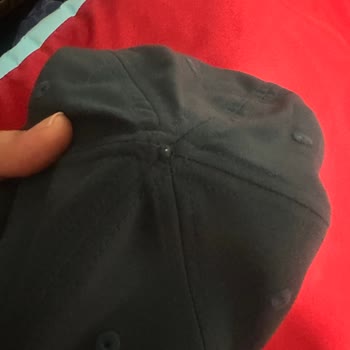 Decathlon Şapka Kusuru: Çivi Yaralanmasına Sebep Oldu, Mağdur Edildik