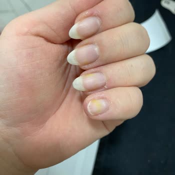 Flormar Oje Tırnakta Sarı Leke Bıraktı, Çıkmıyor