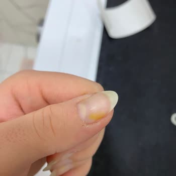 Flormar Oje Tırnakta Sarı Leke Bıraktı, Çıkmıyor