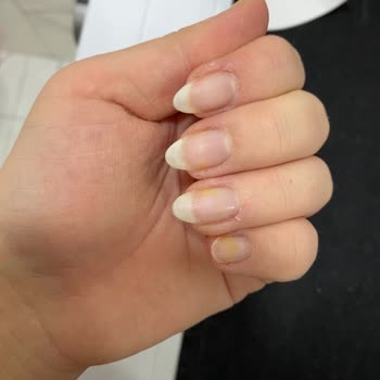 Flormar Oje Tırnakta Sarı Leke Bıraktı, Çıkmıyor